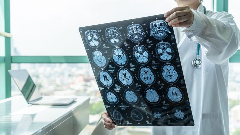 Doctor looking at x-rays of martial arts concussions